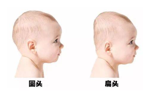 tony发型篇：扁头勿碰的雷区