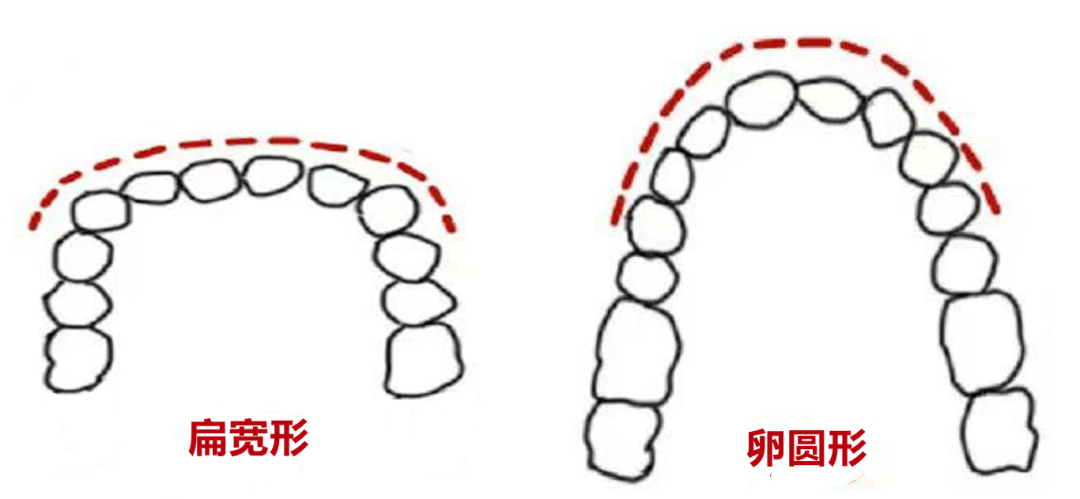 对比今天的吴宣仪，美到路过的蚂蚁都在夸：搞得值！
