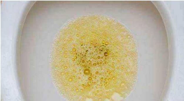 肾脏|尿酸升高后,有3个表现,或许会连累肾脏,别忽视!