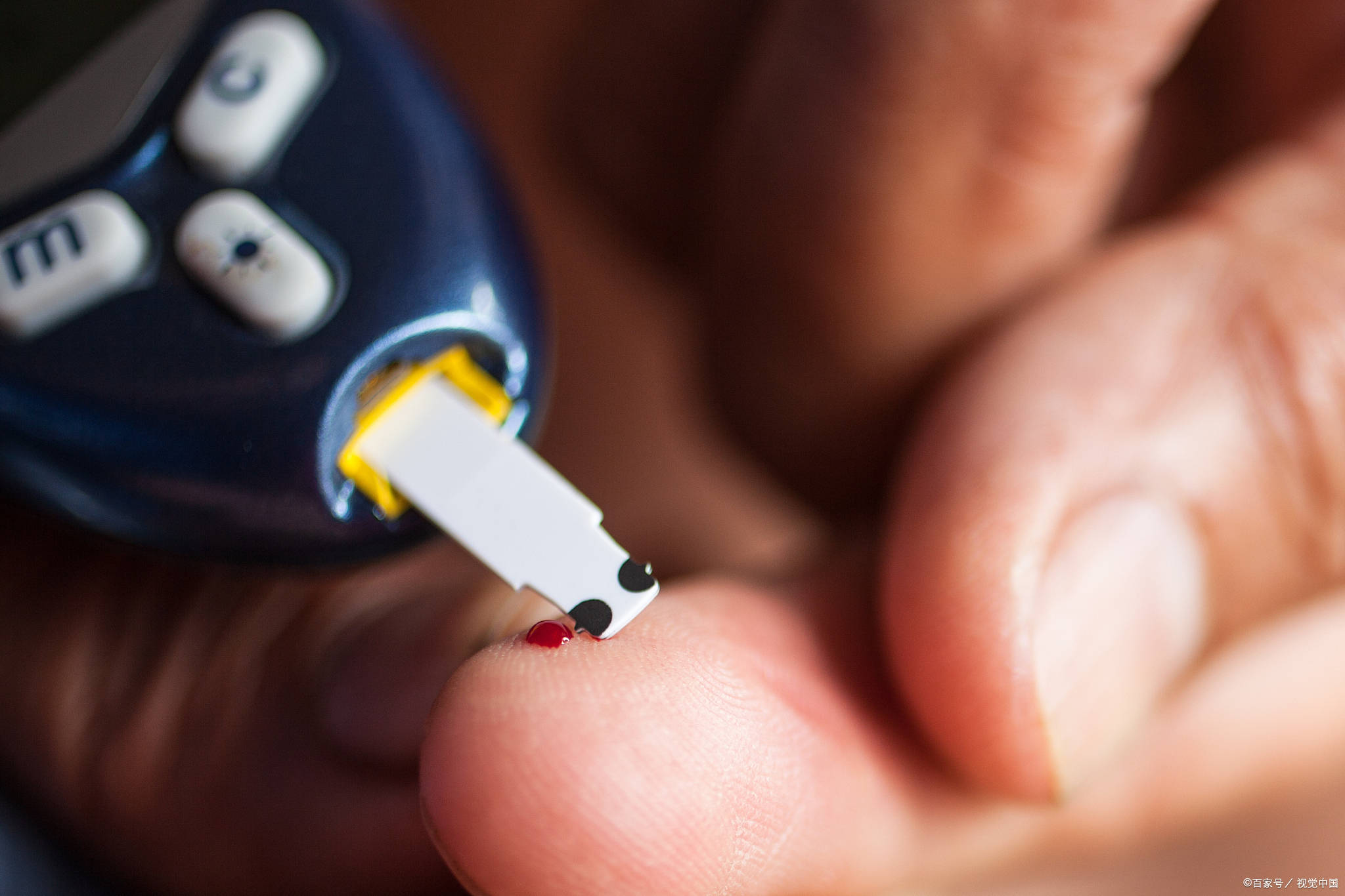 空腹|自测血糖不准?5个细节不能忽视,祖医堂:测血糖黄金时刻要牢记