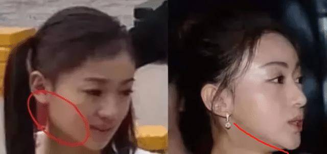 变化那些削骨“一刀切”的明星还好吗？有的已垮掉，小方脸成最后赢家