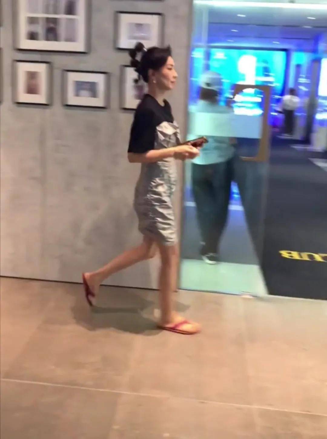 头发 这才是51岁真实的张庭，膝盖有点钙化，一看就是老年人的腿！