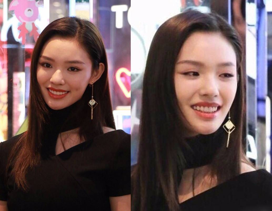 原创女明星假牙大pk谁的嘴巴闭不上谁的嘴里藏着一套房