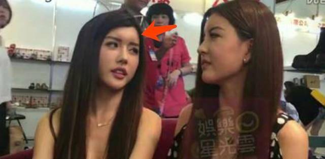 因为女网红公开整容全过程，削骨磨腮后需插喉放血，隆鼻导致嗅觉失常