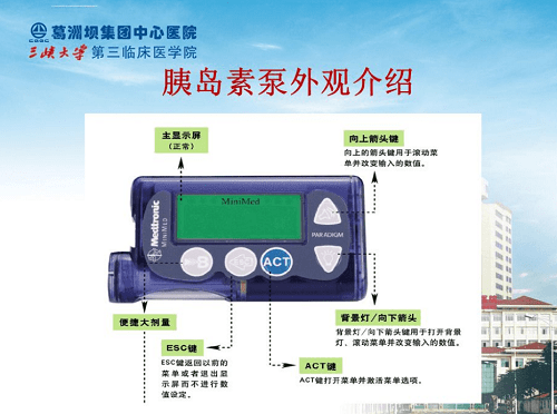 监测|美敦力胰岛素泵替糖尿病患者科学管理控糖治疗