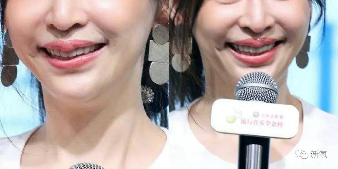 因为这些“不完美”基因，究竟是礼物还是不讨喜的痛处？