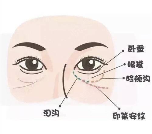 薄且泪沟法令纹眼袋，这些问题护肤品能解决吗？