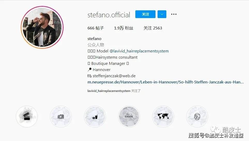 斯蒂芬·扬扎克20岁秃顶，如今却是有上万粉丝的时尚达人！前后反差完全不输楚淇