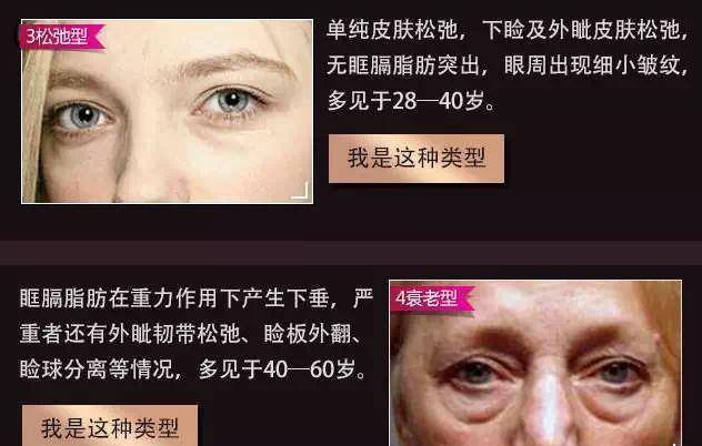 眼袋看完《都挺好》，我被苏大强的这一点惊到了