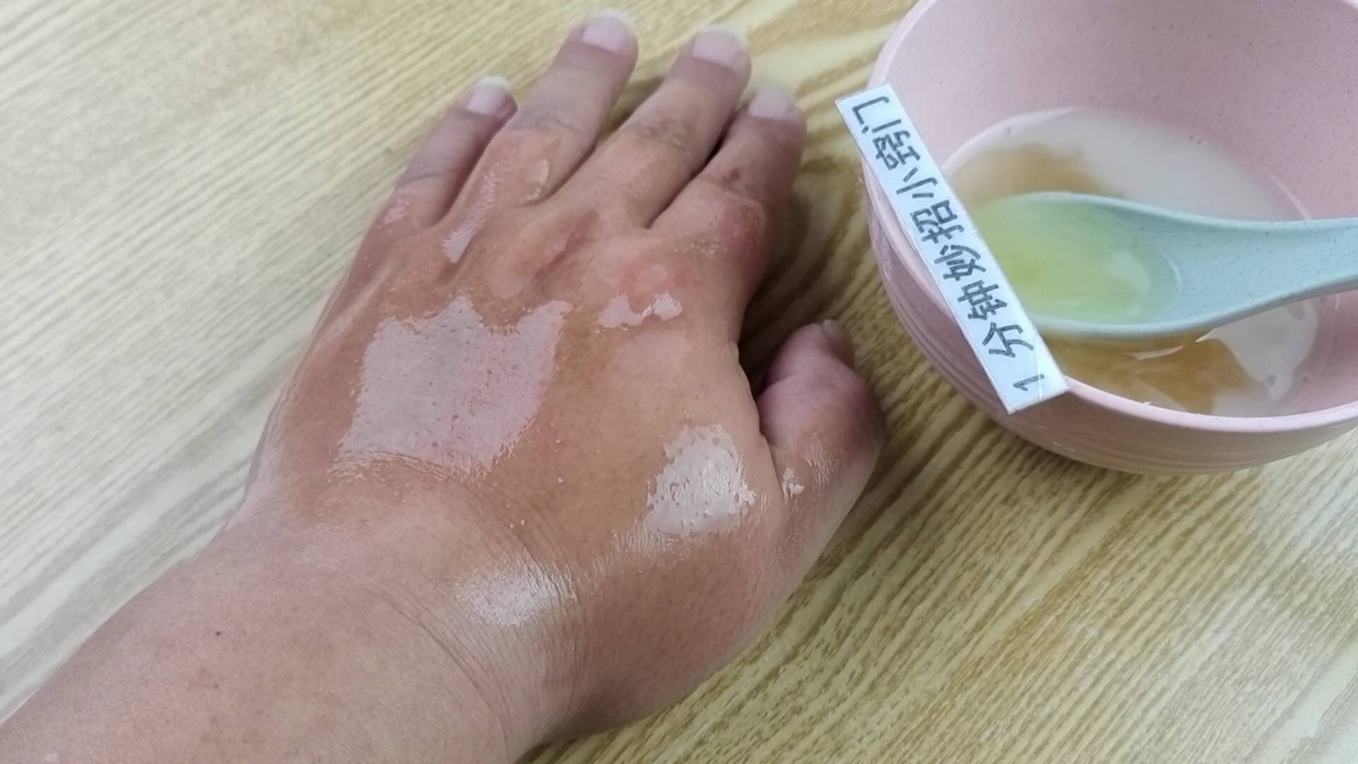 方法脸上皱纹越来越深，教你一土方法，简单好用又省钱