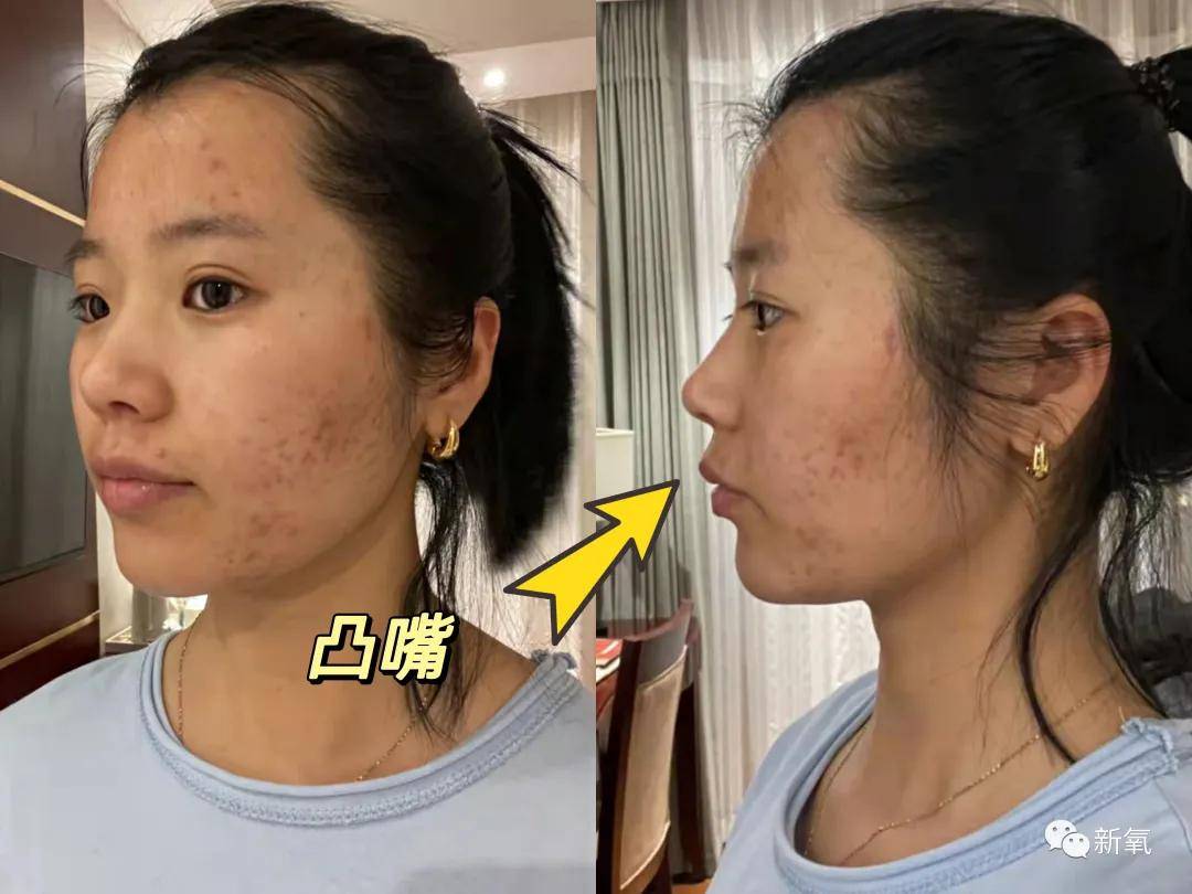 预算预算不过万，我是怎么送粉丝出道的？