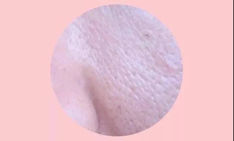 人群嘉玲护肤老师：毛孔粗大怎么破