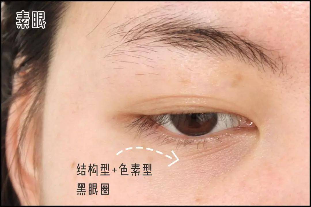 血管3种超实用遮黑眼圈大法，手残党一看就懂！