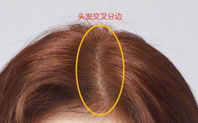 中分掌握这个中分方法,不做发型也显脸小、颅顶高