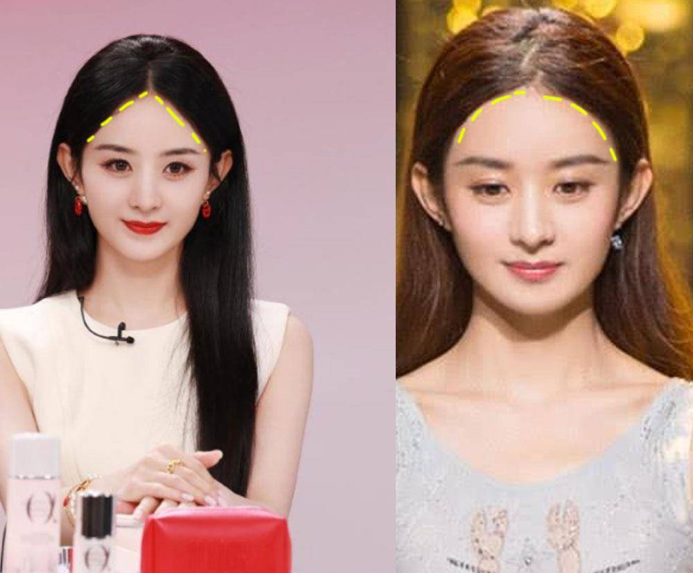 中分掌握这个中分方法,不做发型也显脸小、颅顶高