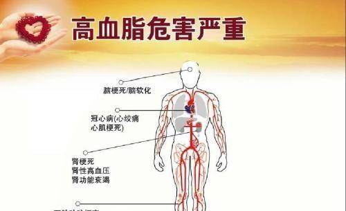 低密度脂蛋白 高密度脂蛋白 都高 476c464b1dc441369b06b2f362c1ec9c.jpeg