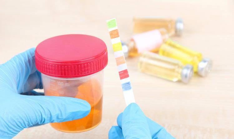 怎么才算尿蛋白 1c2733c495d046fdabd5a703ed54b6f1.jpeg