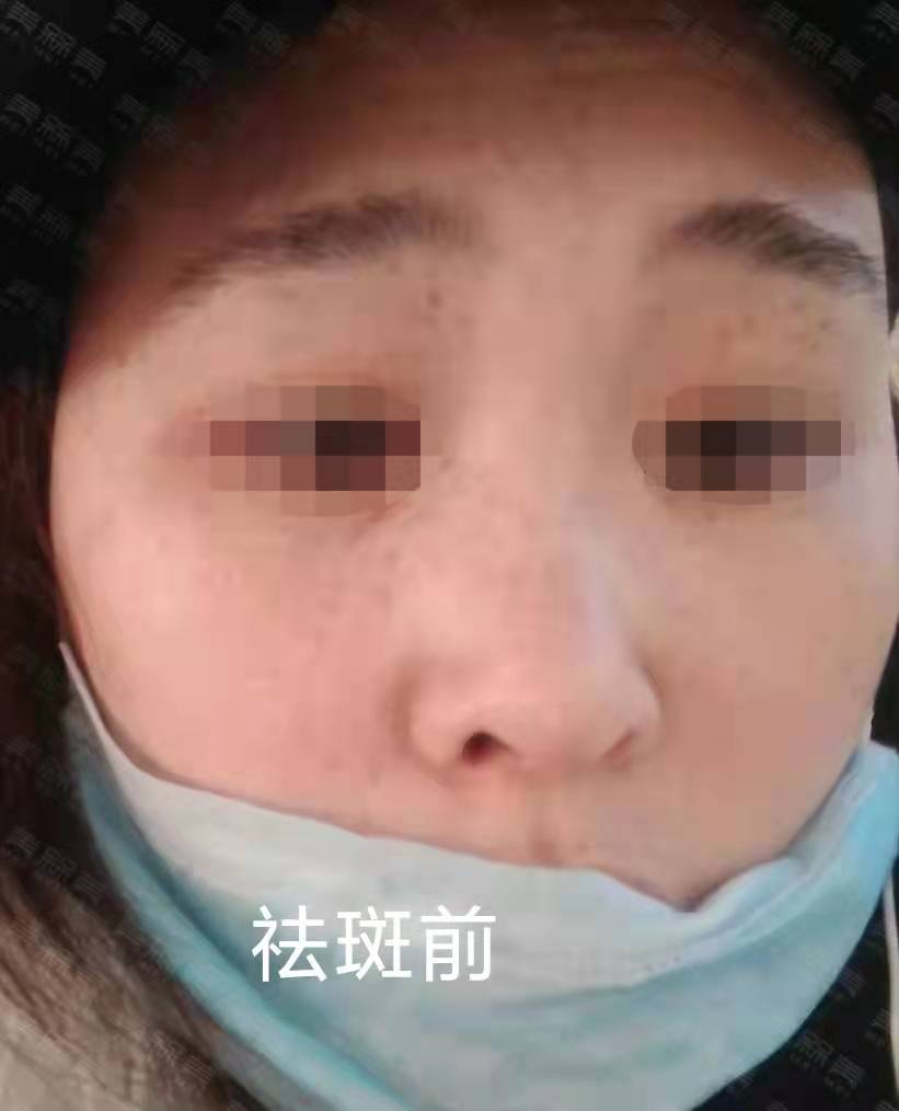 因为【美人汇】从“麻雀女孩”变成“发光少女”