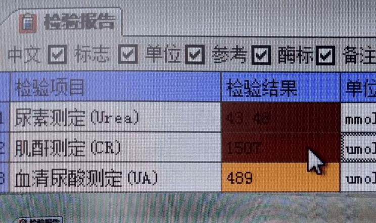 肾脏|尿毒症有什么前兆？除了泡沫尿，这5种症状也是身体在求救