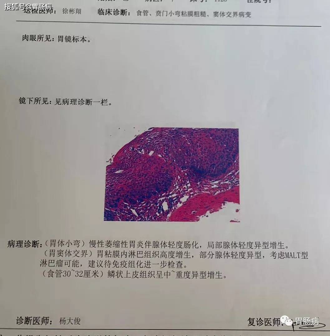 肠镜检查报告单普通图片