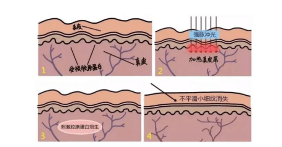 美貌想要延长美貌的保质期，来试试这个项目