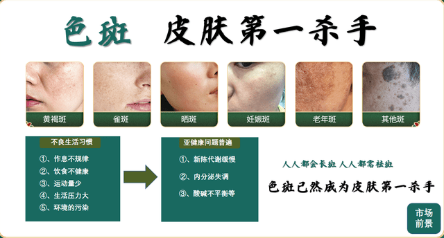 人口「斑后」万亿颜值蓝海市场