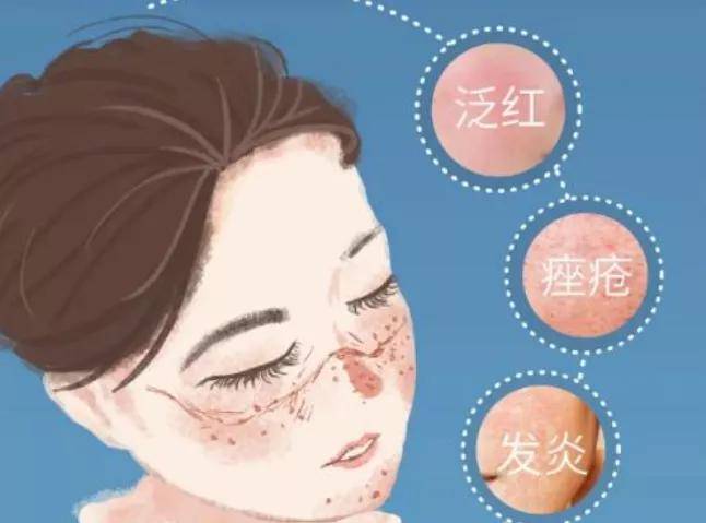 产品想要年轻不烂脸，收好这几个护肤秘诀