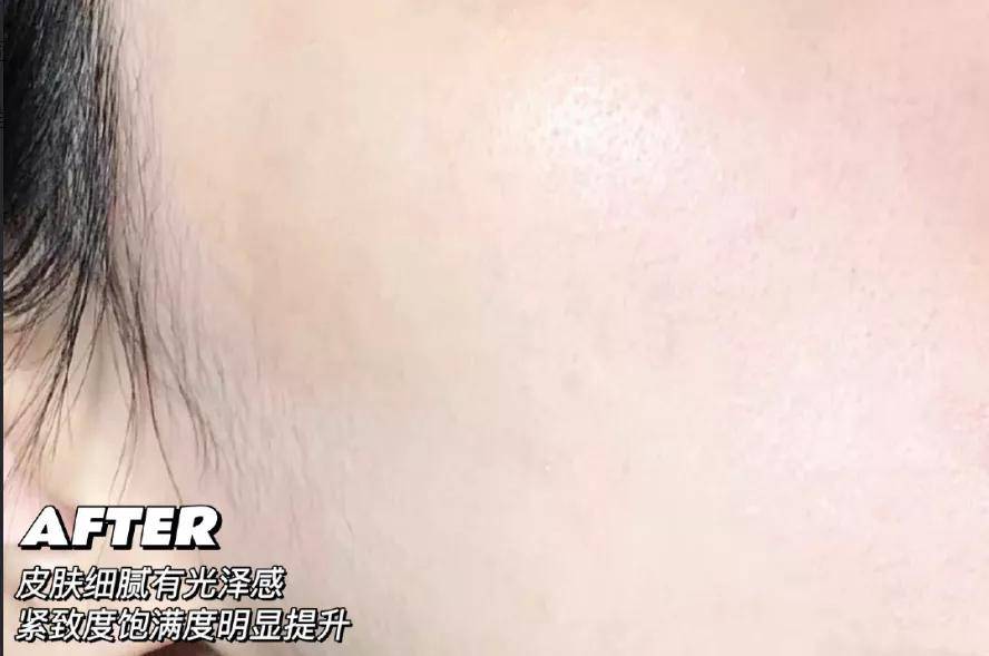 产品想要年轻不烂脸，收好这几个护肤秘诀