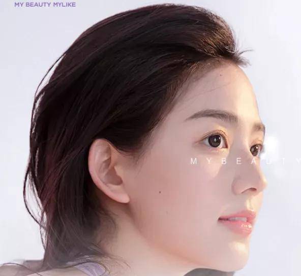 姐妹想要过年光彩照人？这些“应急”项目简直不要太香