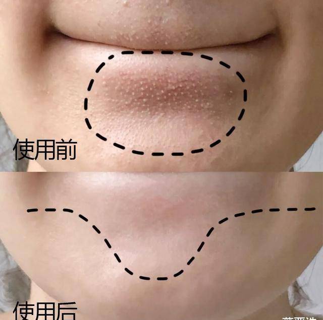 菌落大牌护肤品被曝含致癌雌激素？网友：贫穷又一次救了我