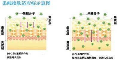 急救春节假期一周倒计时！时间紧迫，做点什么项目可以快速变美？