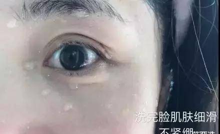毛孔王源脸上痘痘越发严重，众人呼吁让他戒烟，美颜滤镜都救不了
