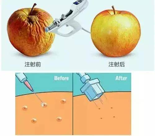 治疗美肤医师郭金月：想要皮肤水嫩，该选择光子嫩肤还是水光？