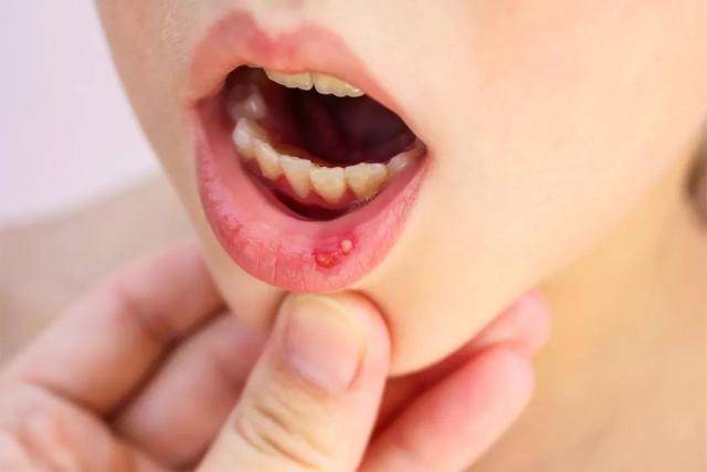 肝脏|肝脏不好，嘴巴会有“感觉”？若嘴巴有这3种现象，可能该养肝了