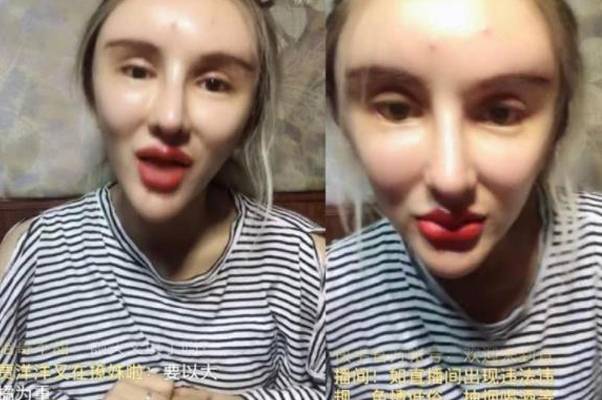 家长花费400多万整容200次的“红粉宝宝”，现状如何？与之前判若两人
