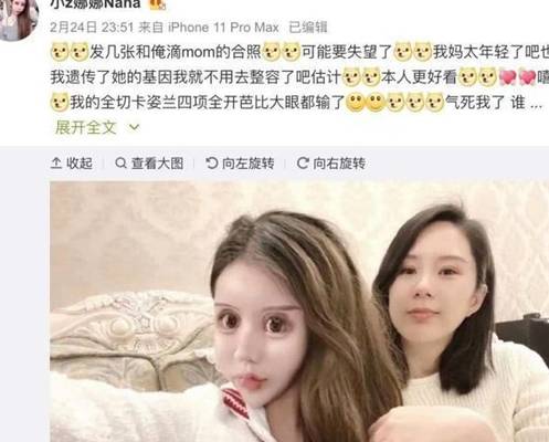 家长花费400多万整容200次的“红粉宝宝”，现状如何？与之前判若两人