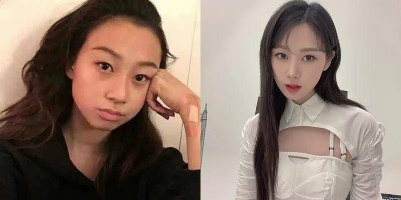 黑头她说自己的美貌主要归功于坚持不懈的皮肤管理？