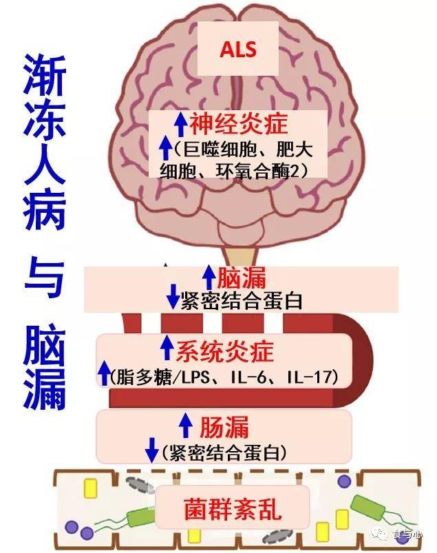 肠漏你必须知道的热知识四