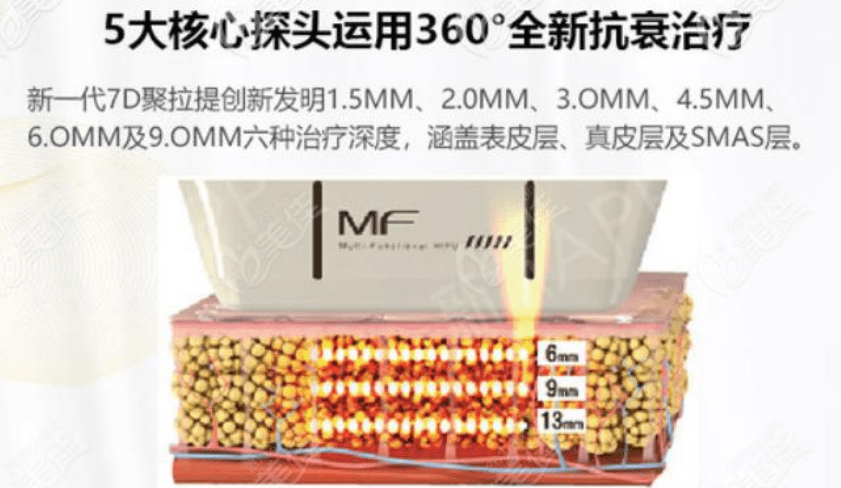 mm神普及：7d聚拉提美容的功效和副作用、原理、危害是什么？