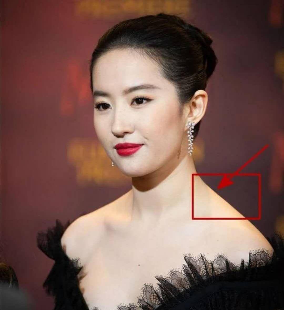 bug 阿娇的腿,杨幂的鼻子,刘亦菲的肩膀,说说女星的长相短板