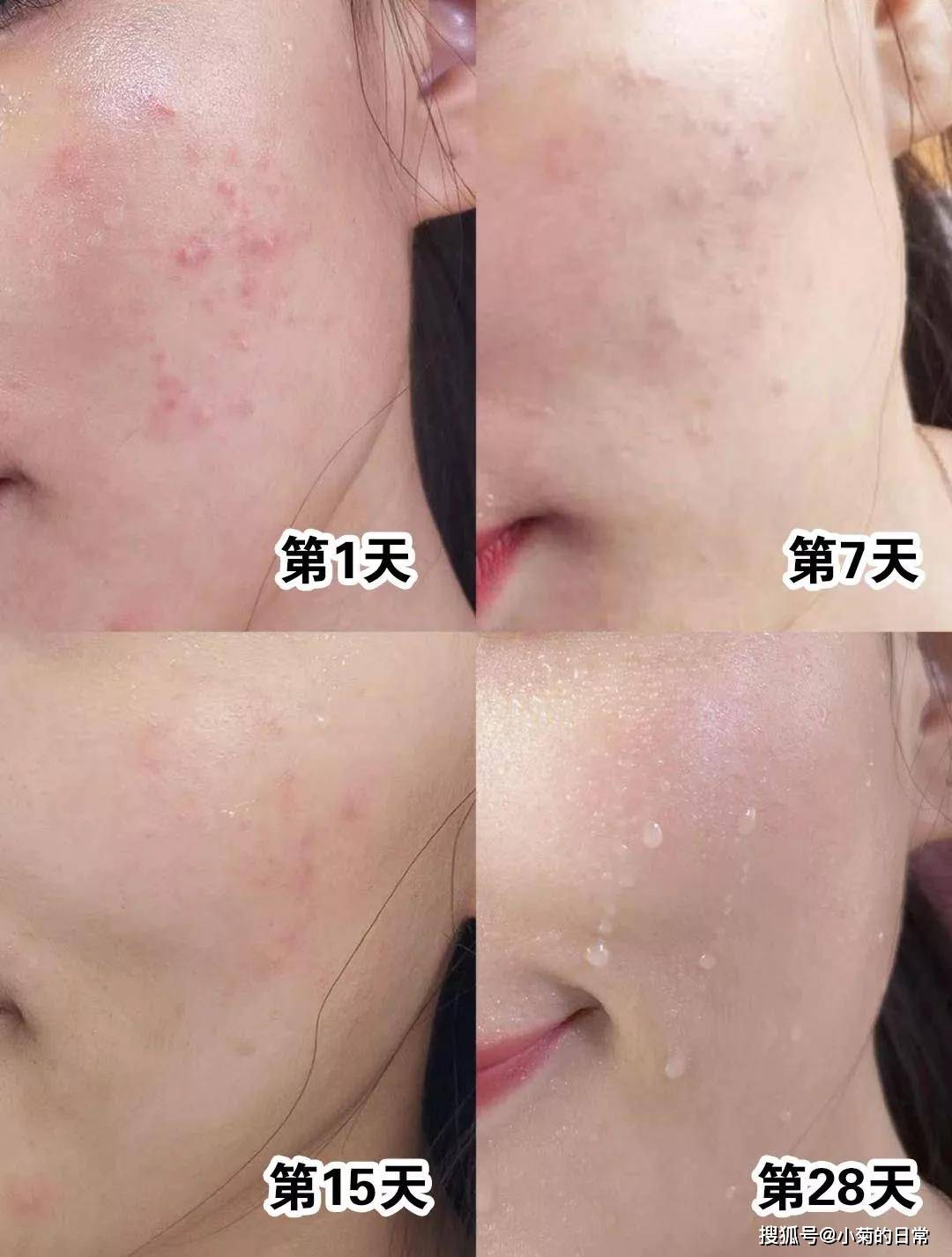脸部建议女人：牢记“4要3不要”，不然皮肤越来越差，还容易长皱纹