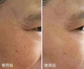 脸部建议女人：牢记“4要3不要”，不然皮肤越来越差，还容易长皱纹