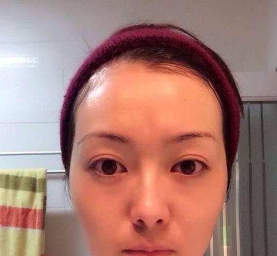 方法脸大显胖，这几个原因告诉你，你的脸为什么那么大，早看早受益！