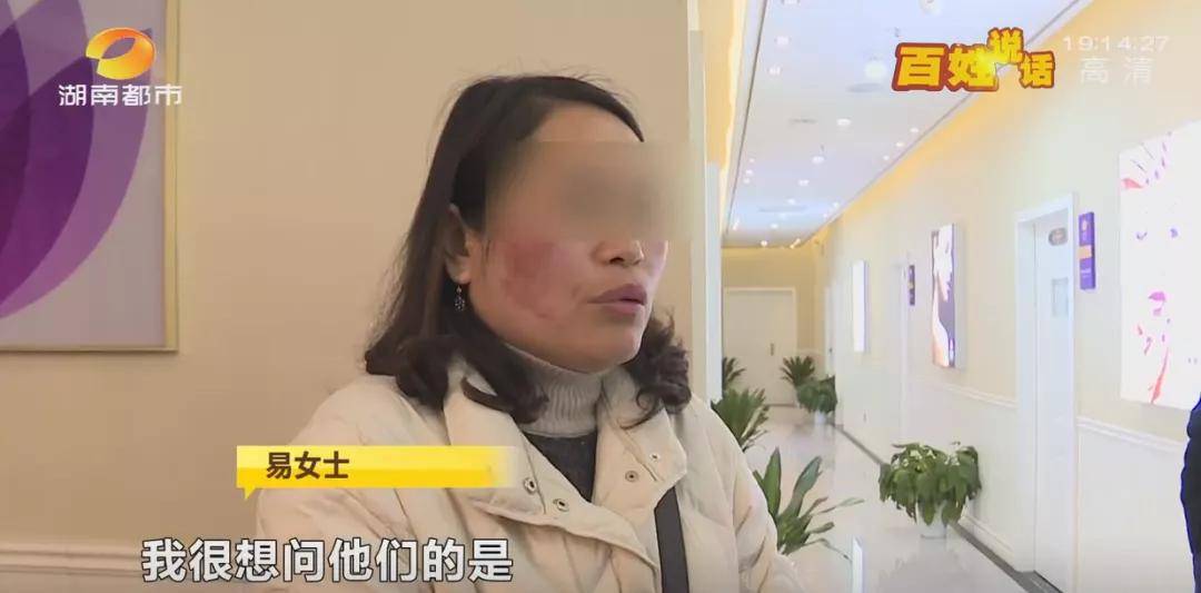 维权长沙一女子花5000元祛斑后懊恼被“毁容”,工作人员:正常现象