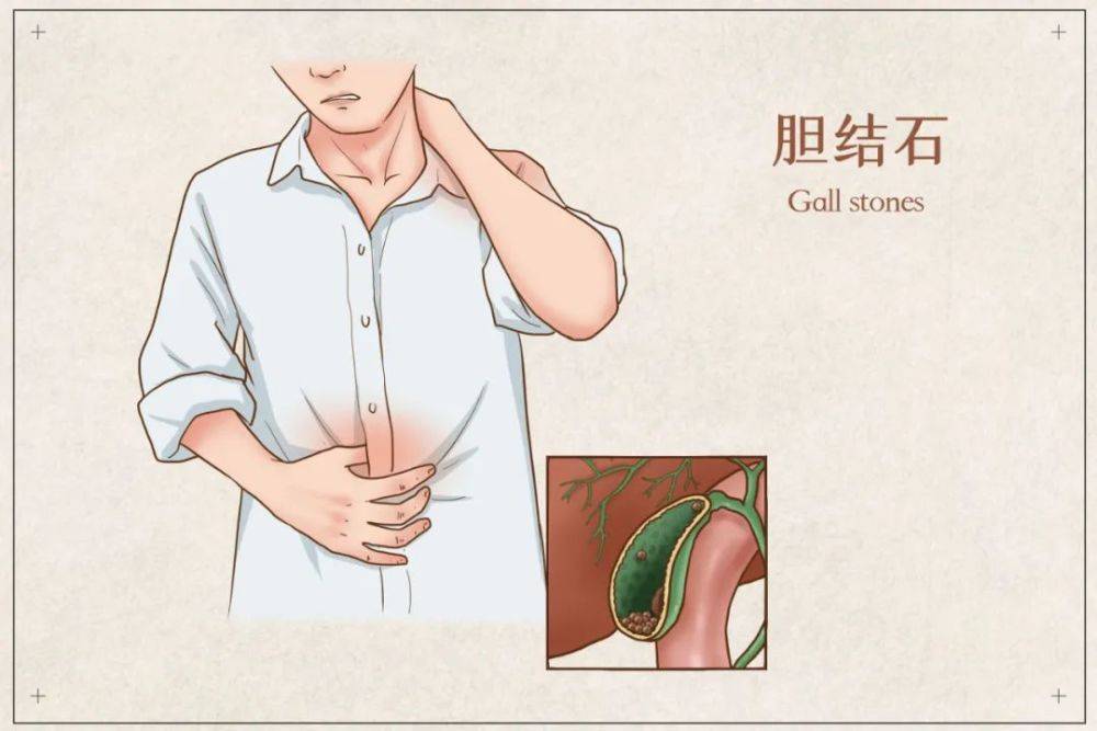 因为|不吃早餐真的会变胖、得胆结石、引发心血管疾病吗？