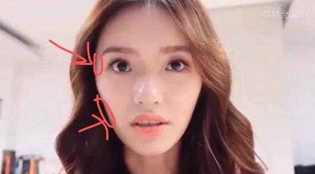 脸部明星整牙后遗症：杨幂脸部松弛，王嘉尔颧骨外扩，宋祖儿法令纹深