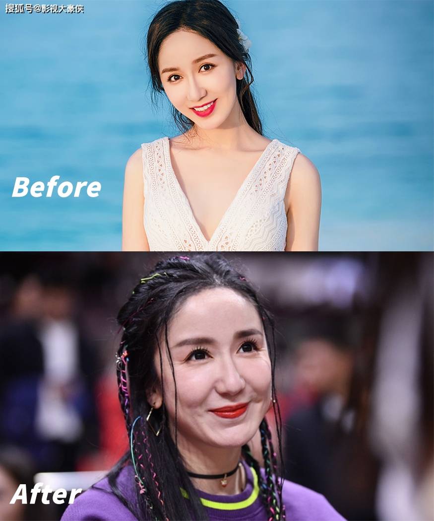 脸部被美容院毁掉的明星，娄艺潇秒变僵尸脸，张檬因整容葬送大好前途