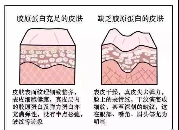 毛孔张嘉倪对自己“真狠”，把黑油皮变成“奶白肌”32岁看着像18少女