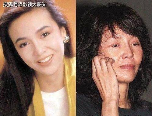 脸部被美容院毁掉的明星，娄艺潇秒变僵尸脸，张檬因整容葬送大好前途