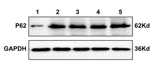 事第二十九集》-western blot 中如何选择内参抗体_蛋白_-actin_实验